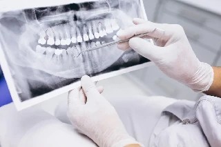Curso Online Básico em Endodontia