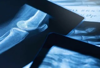 Curso Online Introdução em Radiologia Forense